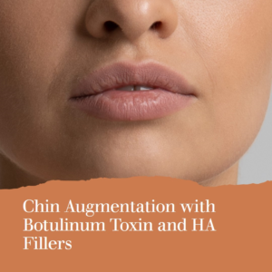 Chin augmentation with Botox and HA