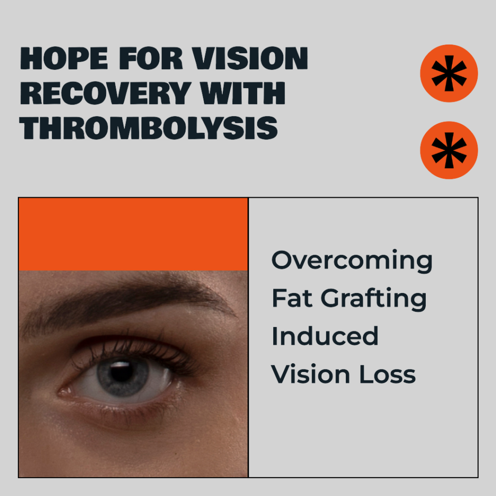 Intrarterial thrombolysis for fat grafting induced vision loss