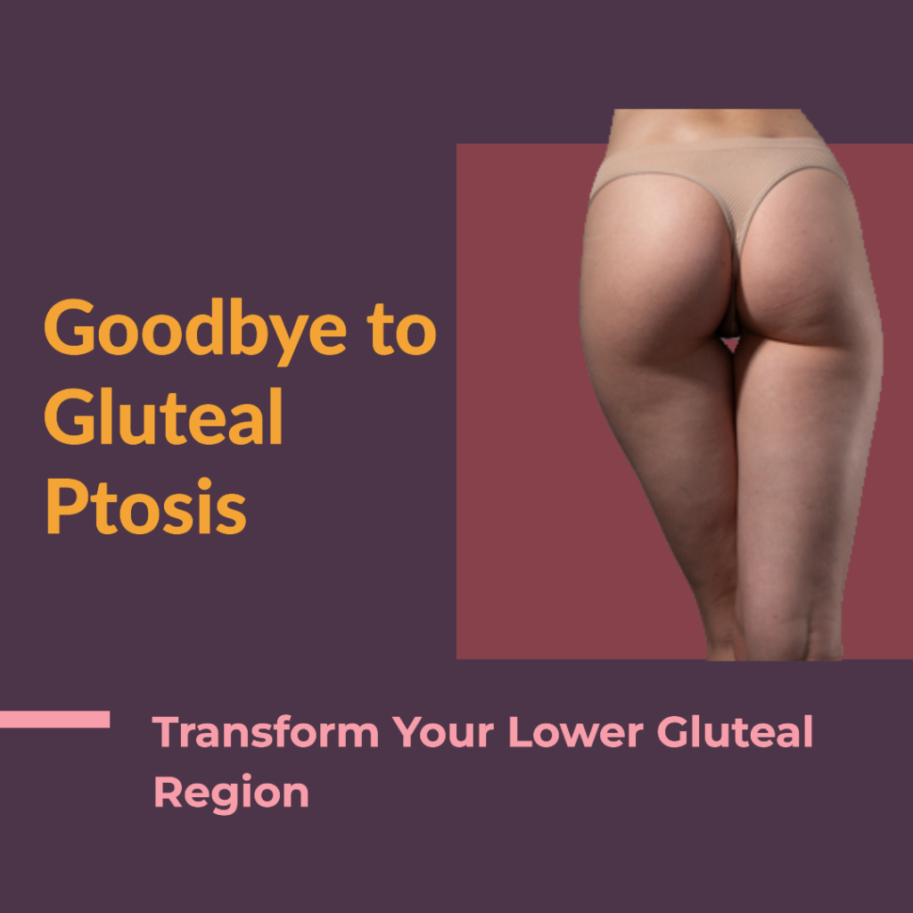 Addressing gluteal ptosis with liposuction and fat grafting
